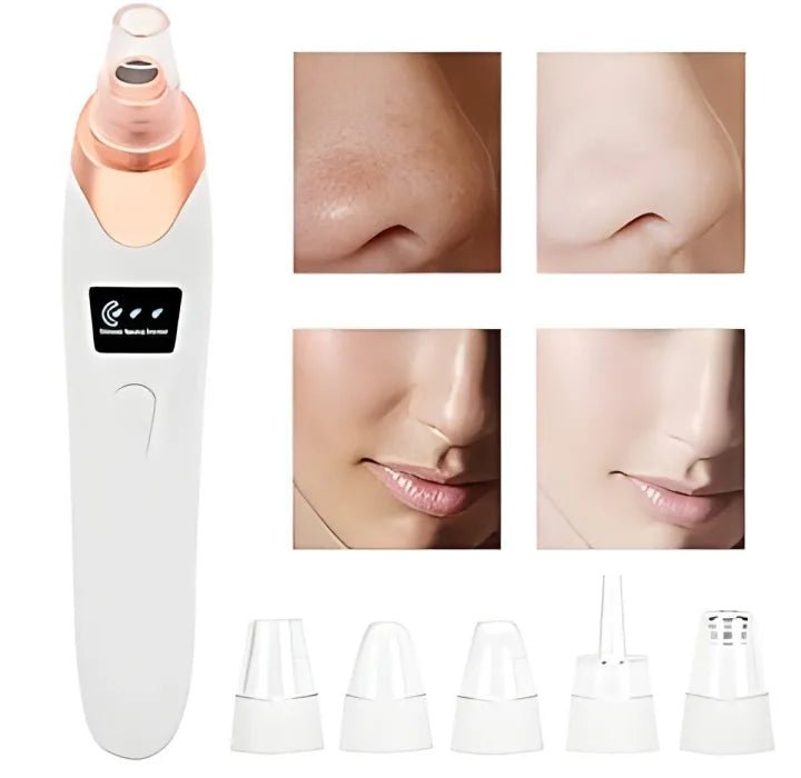 5 - in - 1 Blackhead Remover | Clear Skin in Seconds - Osolex
