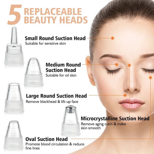 5 - in - 1 Blackhead Remover | Clear Skin in Seconds - Osolex