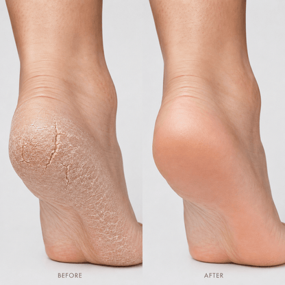 Urea+ Foot Repair Cream - Osolex