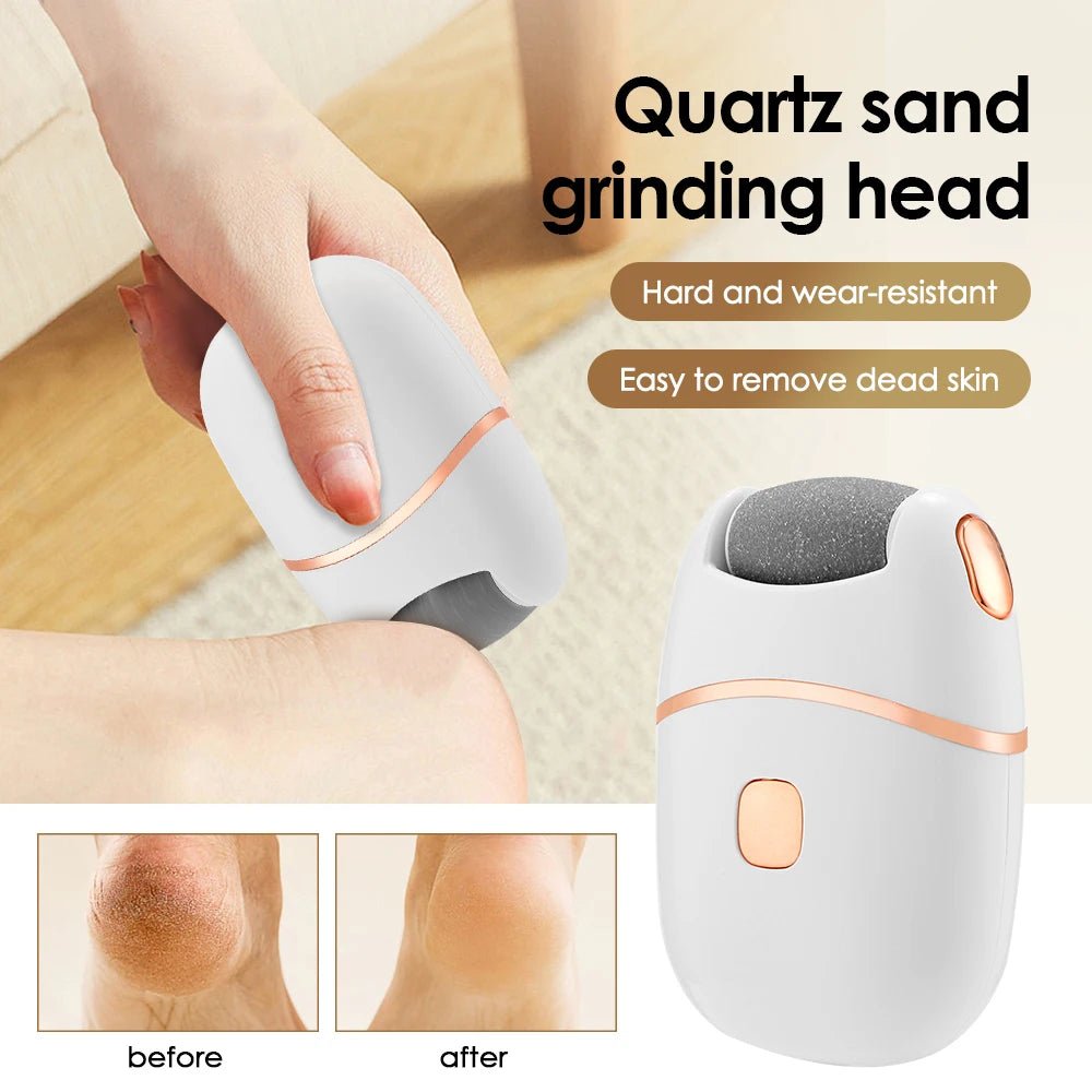Osolex™ Electric Pedicure 2.0 - Osolex