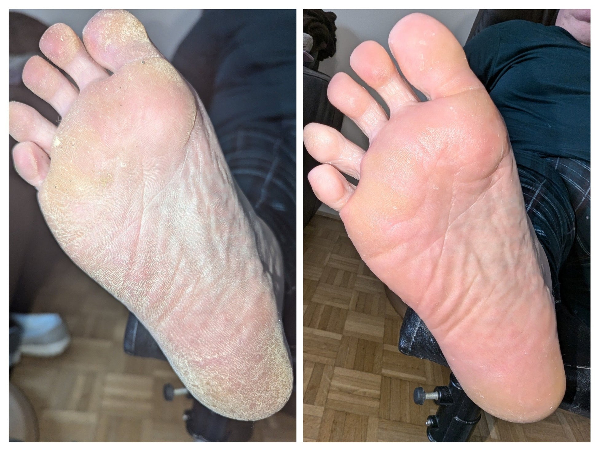 Urea+ Foot Repair Cream - Osolex