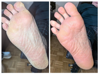 Urea+ Foot Repair Cream - Osolex